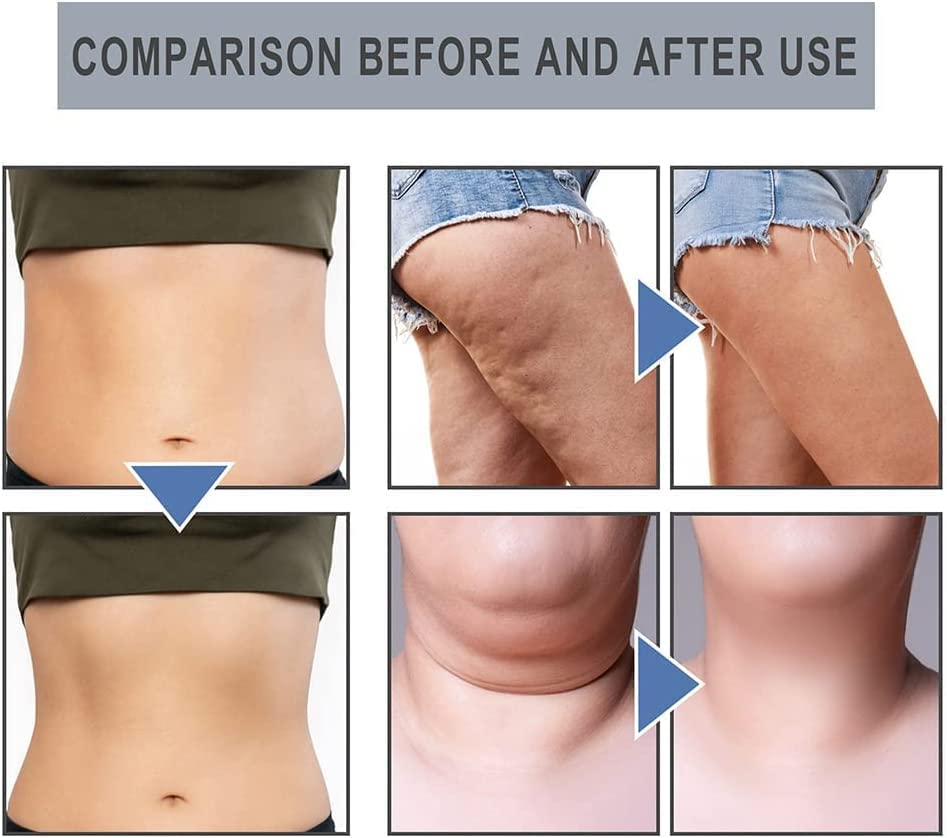 14Pcs Superslim S_limming & Detoxifying Essential Oil Ring, Firming Essential Oil Ring Heath Secret