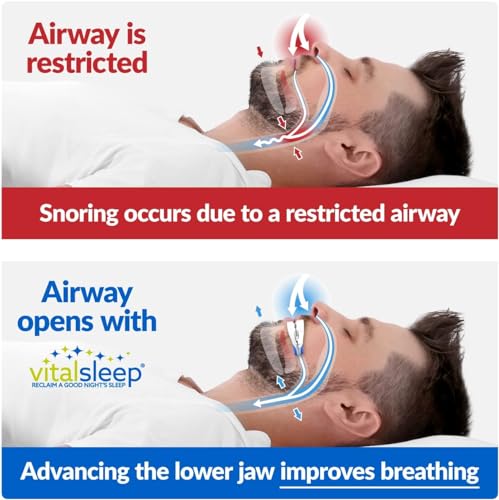 VitalSleep Anti-Snoring Mouthpiece, Adjustable Jaw Positioning Vital Sleep