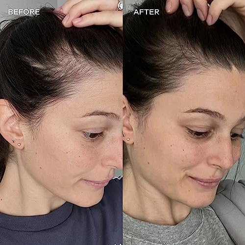 Vida Glow - Natural Hydrolysed Marine Collagen Sachets | Promotes Glowing Skin + Smooths Fine Lines Vida Glow