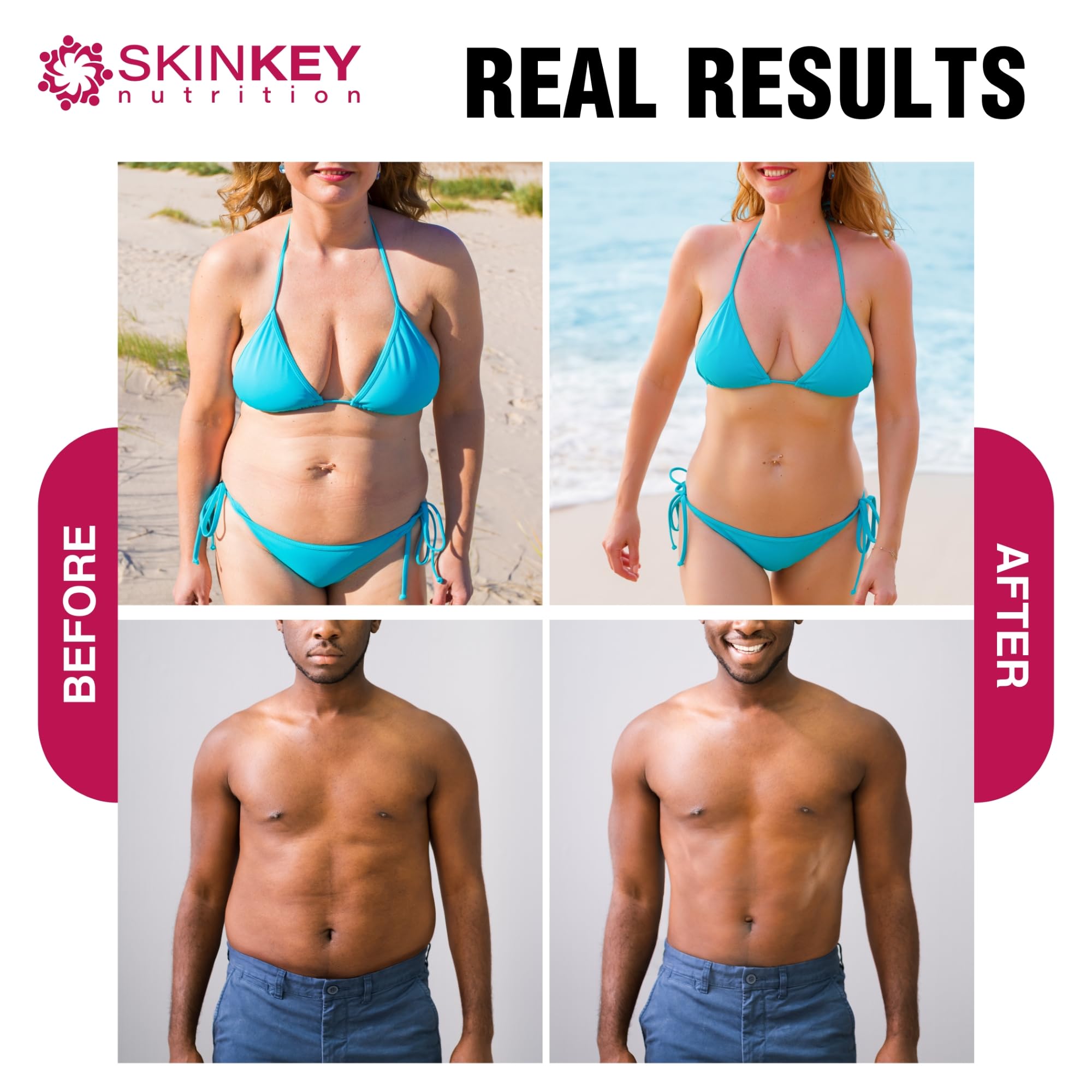 Weight Loss Pills for Women - Fat Burner Diet That Work Fast & Men Made in USA SKINKEY Nutrition